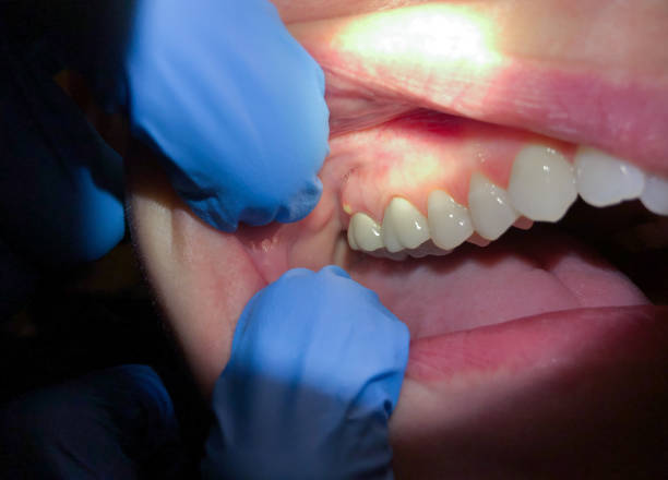 Best Weekend Emergency Dentist in Anadarko, OK